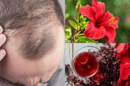 Hair falling at double the speed?  Hair grows even on bald heads with this flower;  Know how to use it?  - India TV Hindi