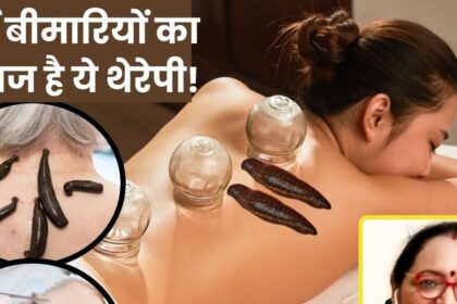 Raktamokshan is the treatment for blood related problems, toxic substances are removed from the body, know the process and 5 big benefits.
