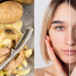 Raw potato works effectively on freckles, know the right way to use it - India TV Hindi