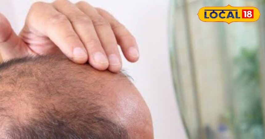 Are you also troubled by hair fall, start taking care from today, know the reasons due to hair fall.