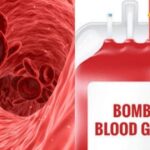 'Bombay Blood Group' is rarely found, listen to what experts said about it