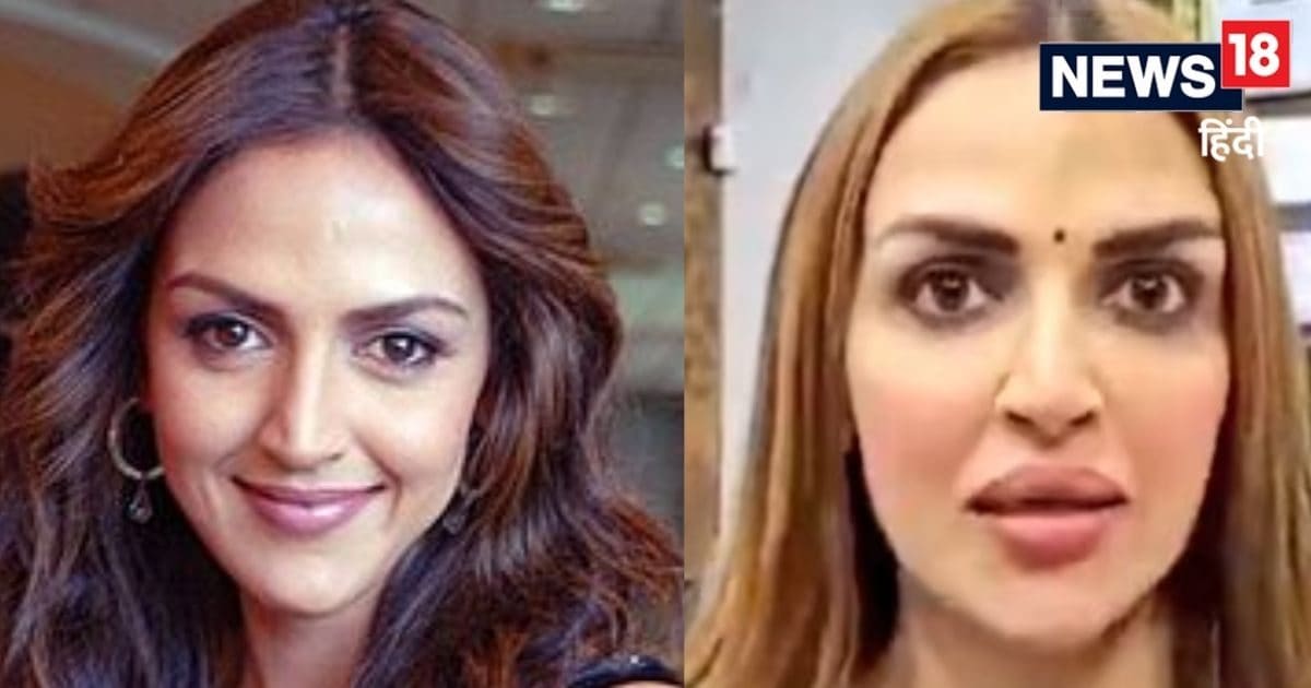 Esha Deol got lip surgery done?  Netizens were heartbroken to see, pictures of then and now went viral