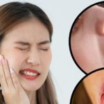If tongue and cheek get cut while eating or speaking, do not worry at all, follow 5 home remedies, oral injury will be cured.