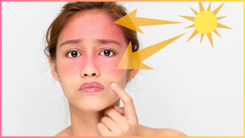 Your face is turning red after going out in the sun, apply these 2 things as soon as you reach home - India TV Hindi