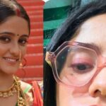 Fans upset after seeing swollen face and swollen lips of 'Gum Hai Kisi Ke Pyaar Mein' Sai's