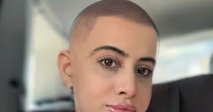 Has Urfi Javed gone bald?  Netizens were surprised to see this condition of the actress, one said- Mentally disturbed