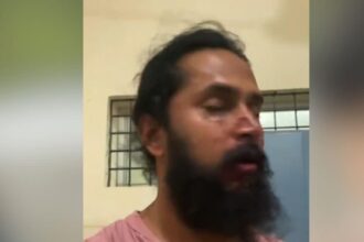 VIDEO: This actor was going to the temple with his mother, when suddenly a group of 20 people attacked him, his nose was broken.