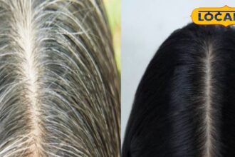 If you want to turn your white hair black naturally, then try this remedy, you will see the effect soon!