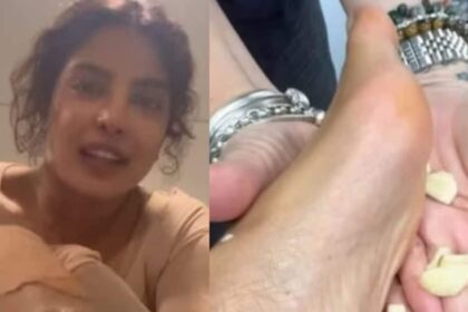 Priyanka Chopra got injured on 'The Bluff', her hands and feet were peeled, adopted a local remedy on foreign soil, rubbed a lot of garlic