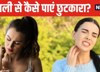 Itching is making life worse in rainy season, know from the doctor what are its causes, how to prevent it
