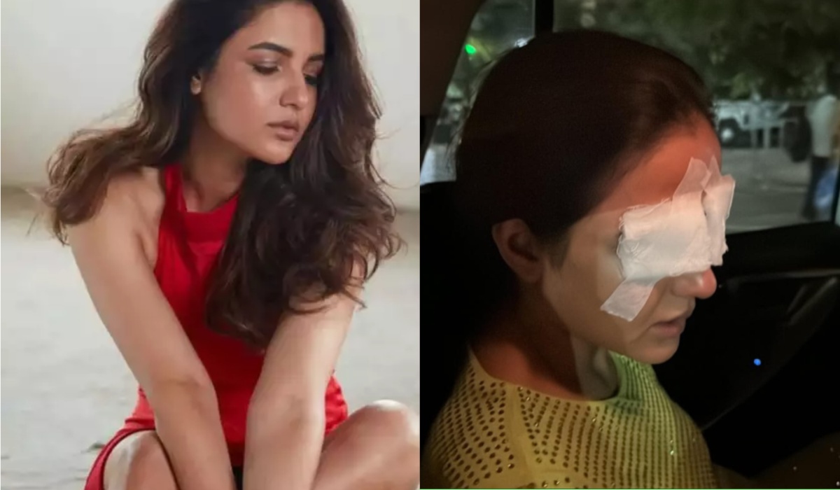 Jasmine Bhasin suddenly lost her sight, is in pain, her cornea got damaged - India TV Hindi