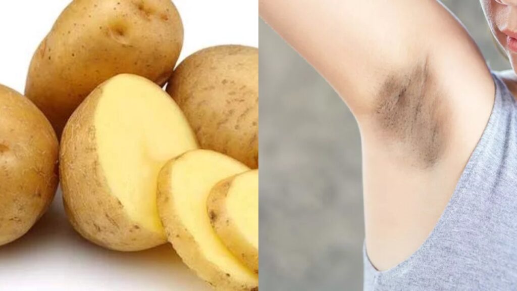 Potato has no competition in removing blackness and tanning of underarms, know how to use it? - India TV Hindi