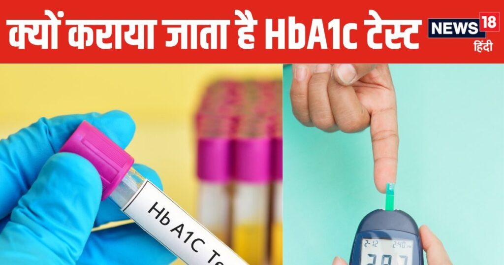 Who should get HbA1c test done? What is its connection with diabetes, understand here