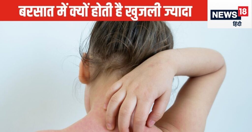 Why is there so much itching in this season? Don't worry, know the formula to deal with it here