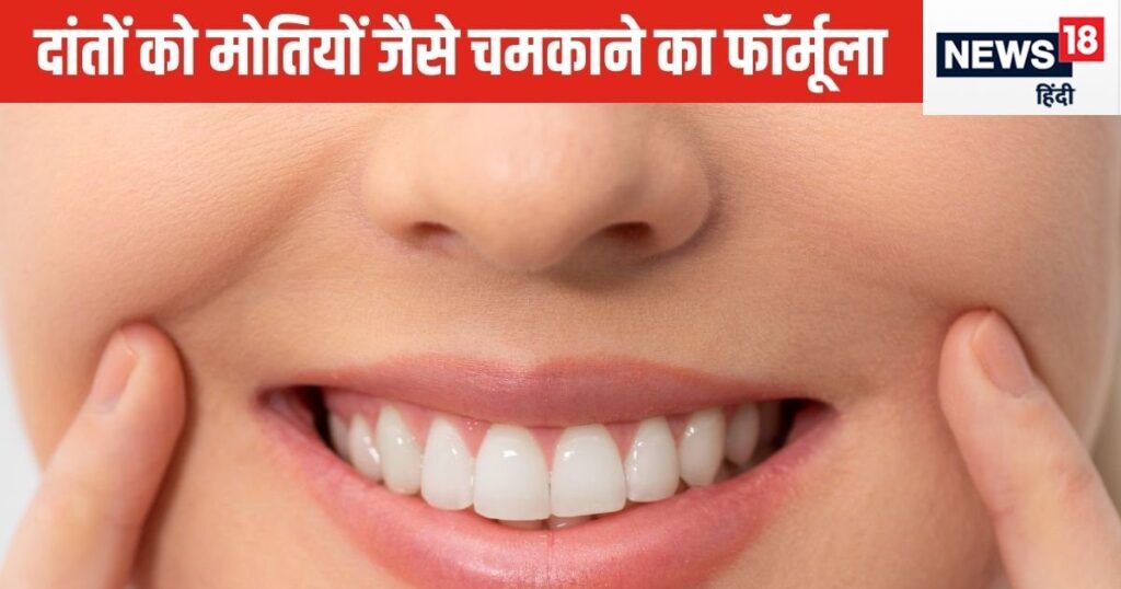 Will baking soda make your teeth shine like the moon? Expert tells the formula, solution at a nominal cost