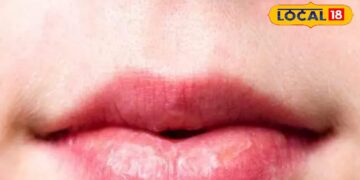 Are your pink lips getting dark too? Follow these tips immediately