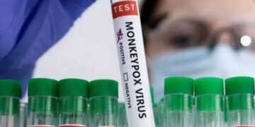 Case of 'Monkeypox' found in this state of India, a person who came from Dubai got infected - India TV Hindi