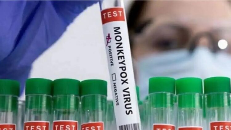 Case of 'Monkeypox' found in this state of India, a person who came from Dubai got infected - India TV Hindi