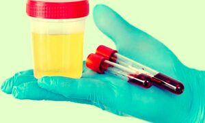 'Do not ignore if blood comes in urine, take doctor's advice immediately'