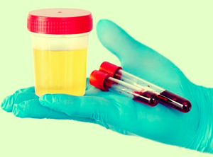 'Do not ignore if blood comes in urine, take doctor's advice immediately'