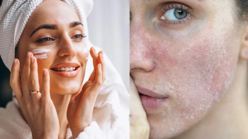 Do this work after waking up in the winter morning, your skin will never dry, it will always remain glowing - India TV Hindi