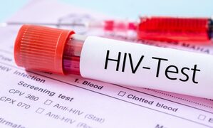 Global HIV cases to exceed 2.2 million by 2033: Report