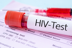 Global HIV cases to exceed 2.2 million by 2033: Report