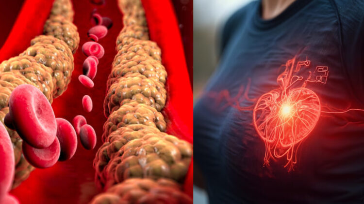 How much cholesterol is dangerous, when does the dangerous condition arise? Know the complete chart - India TV Hindi
