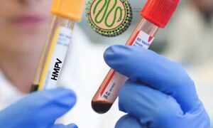 Human metapneumovirus cases are declining in northern provinces: China