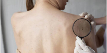 If these signs start appearing in the body then be careful, it may be cancer, know the way to avoid it
