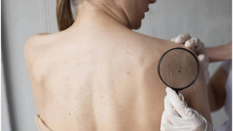 If these signs start appearing in the body then be careful, it may be cancer, know the way to avoid it