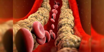 If you want to get rid of problems like cholesterol then do this work after waking up in the morning, there will be no need of medicine.