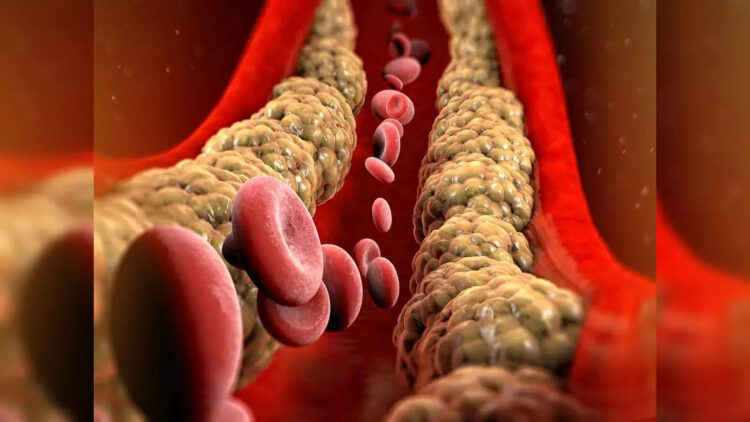If you want to get rid of problems like cholesterol then do this work after waking up in the morning, there will be no need of medicine.