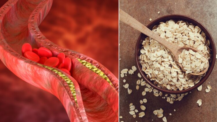 If you want to reduce high cholesterol in a week, then what should be included in your diet? - India TV Hindi
