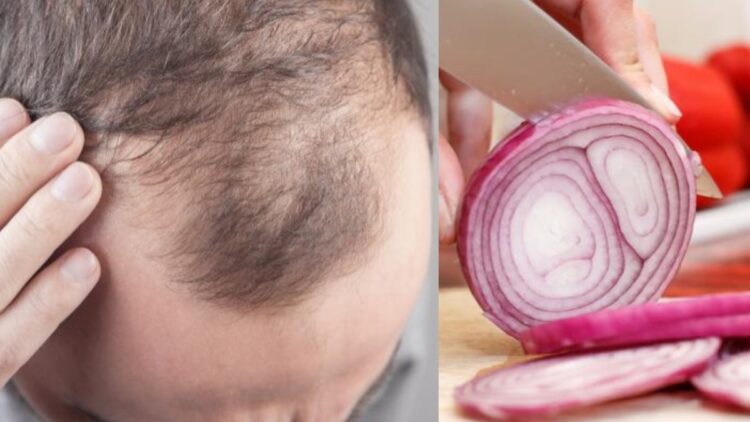 Like leaves, hair has started falling, apply this vegetable juice on the head, hair in a few days - India tv hindi