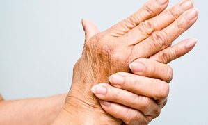 New AI technology will quickly detect arthritis, lupus