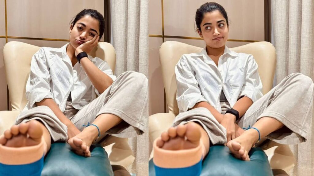 Plaster on leg, yet smile on face, Rashmika Mandanna shows pain even in injury - India TV Hindi