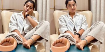 Plaster on leg, yet smile on face, Rashmika Mandanna shows pain even in injury - India TV Hindi