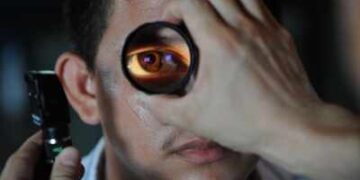 Regular eye examination can accurately predict the risk of stroke: Research