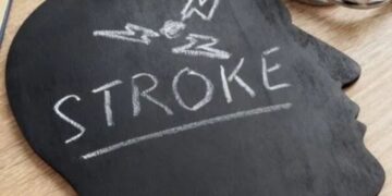 Stroke Myths: People immediately trust these 5 myths related to stroke, experts - India tv hindi