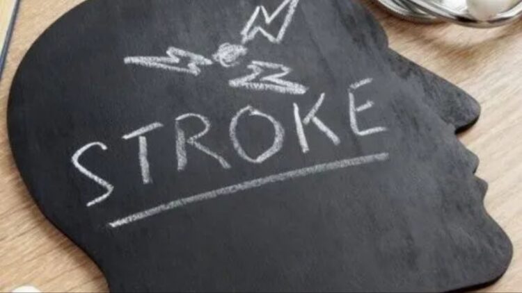 Stroke Myths: People immediately trust these 5 myths related to stroke, experts - India tv hindi
