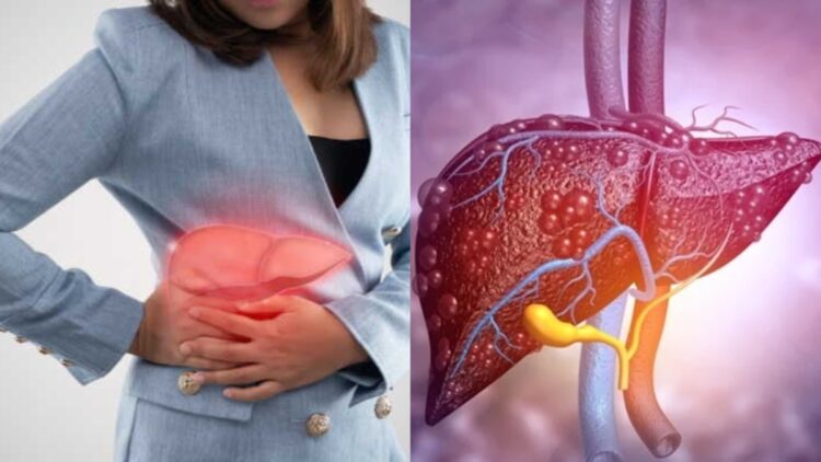 These 3 foods gradually damage the liver, should not be consumed even by mistake - India TV Hindi
