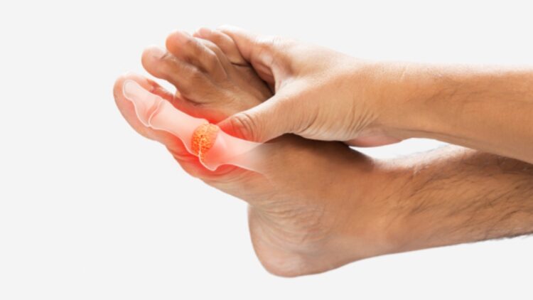 These home remedies are very effective in reducing increased uric acid - India TV Hindi
