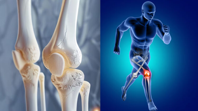 This vitamin deficiency can shatter bones, danger increases in winter - India tv hindi