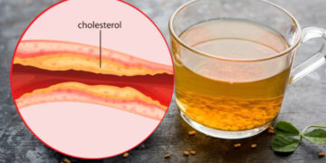 This yellow water will melt the dirty cholesterol stuck in the veins - India TV Hindi
