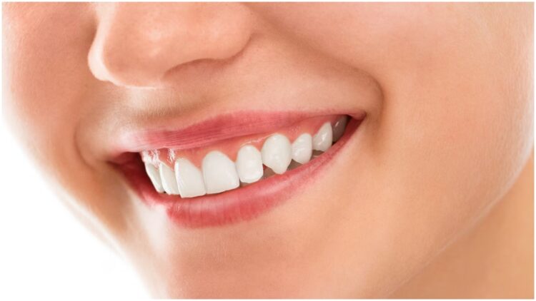 How to clean teeth with lemon? Follow these effective ways for white and shiny teeth - India tv hindi