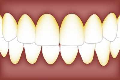 Important to measure bacterial levels present in the mouth to quickly detect Alzheimer's danger: Study