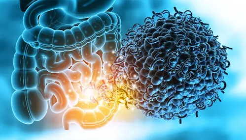 Study told how the risk of multiple sclerosis is connected to Gut microbiome
