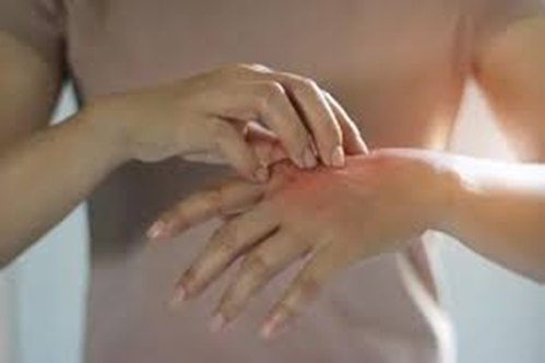 The benefits of itching are no less! Research claims bacteria staff reduced