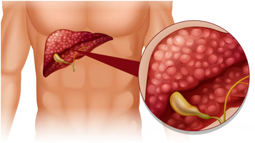 Want to reduce the risk of fatty liver, include these things of food and drink in the diet - India tv hindi